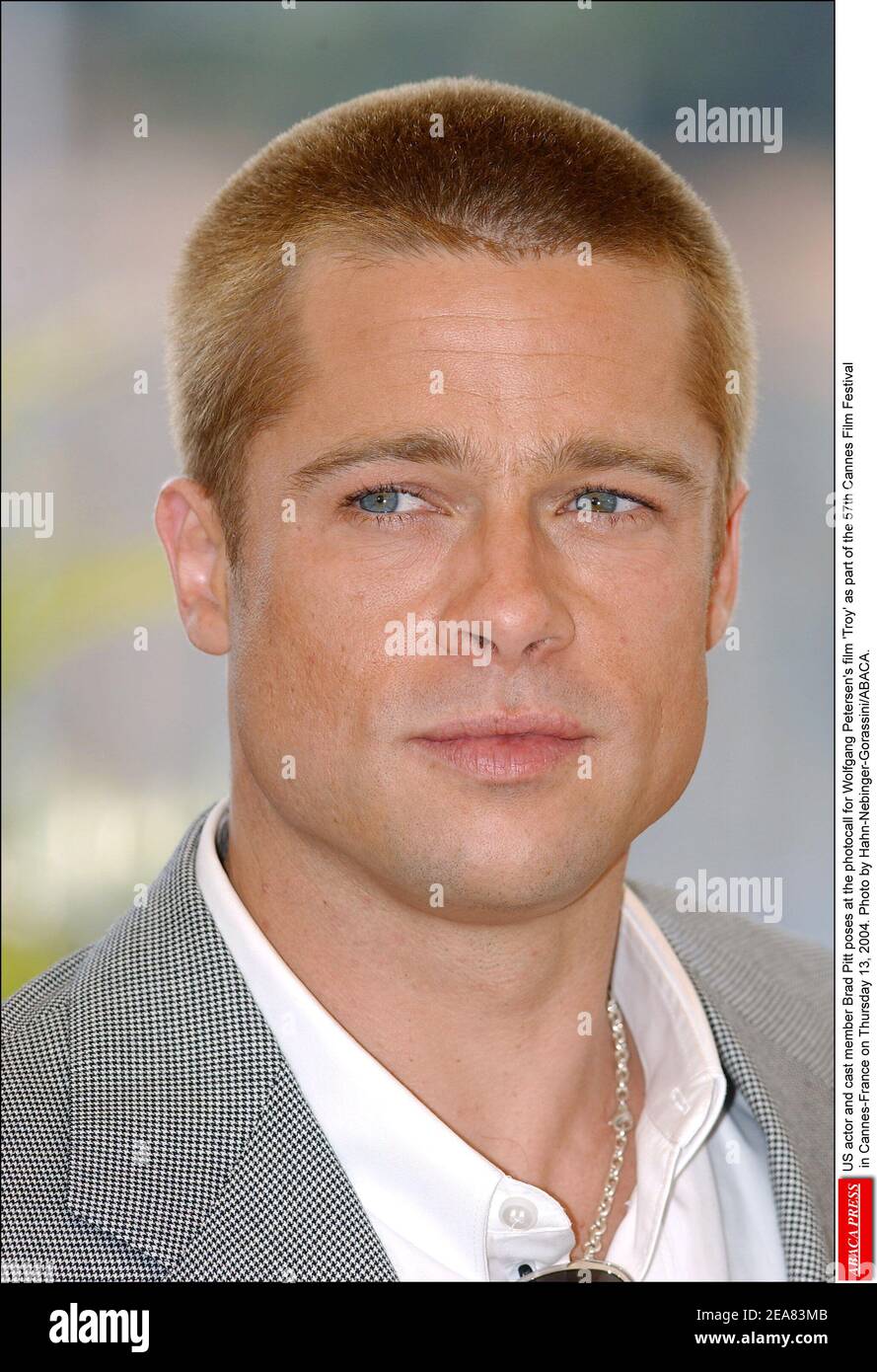 Brad Pitt Hair Transplant