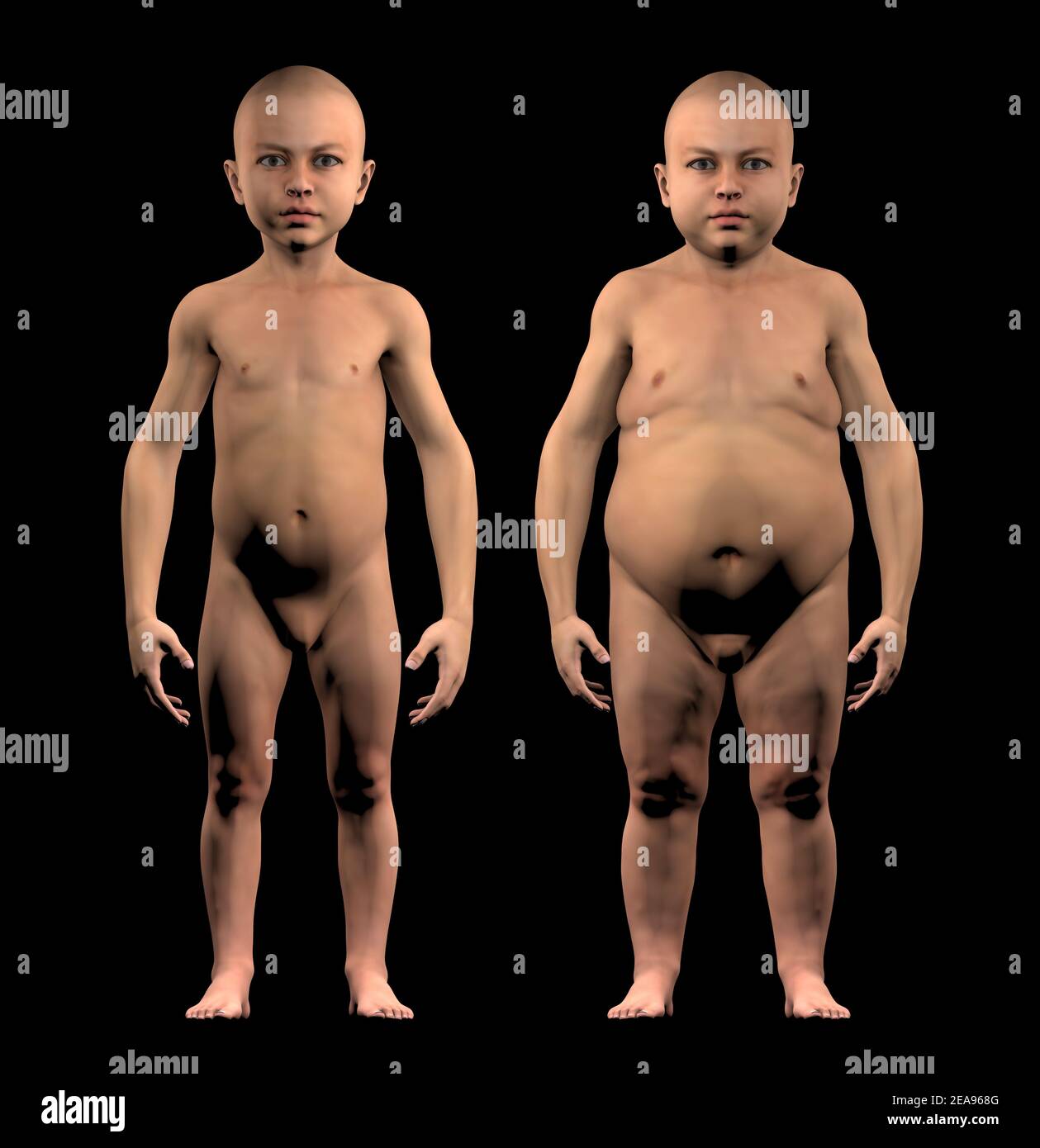 A normal-sized child and an obese child in comparison. Problems of obesity in children. Diet and exercise. Risk: cases of diabetes, dyslipidemia Stock Photo