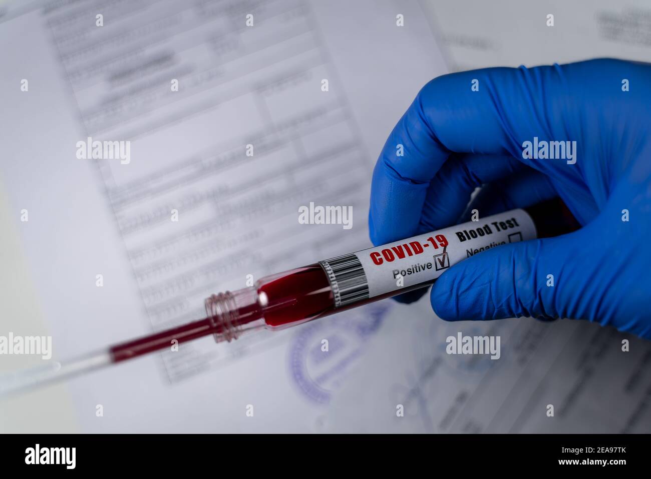 Pipette extracting sample from blood collection tube with positive result for COVID 19. Isolated on background of medical papers. Coronavirus Stock Photo
