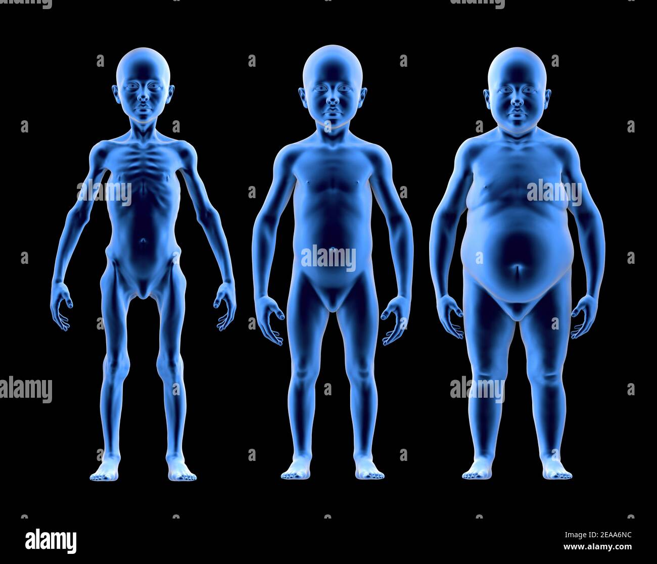 Undernourished child, with normal build and obese child in comparison. Problems of food shortage and obesity in children. 3d render Stock Photo