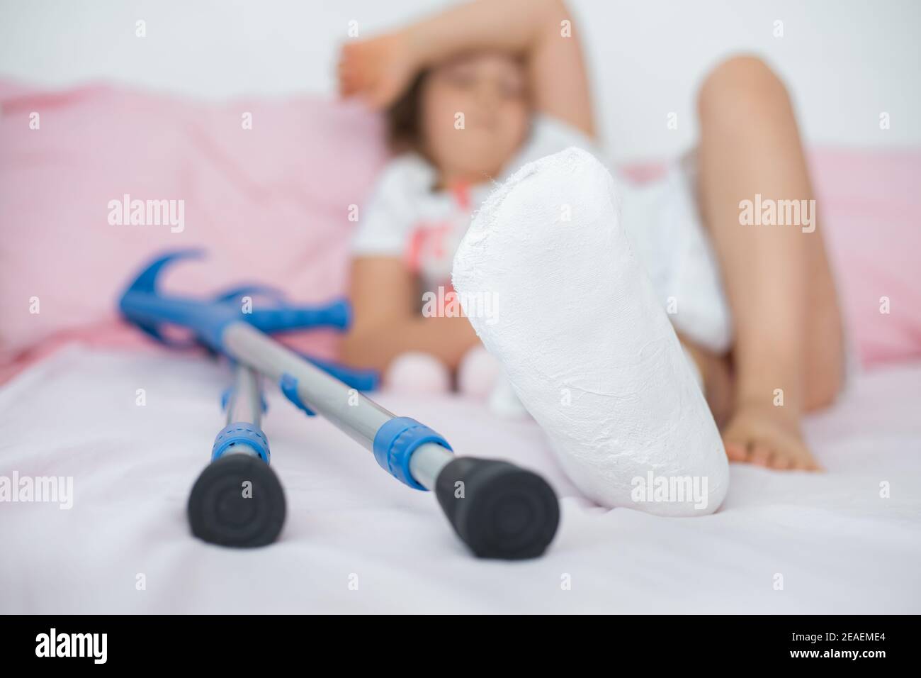 A teenage girl lies on a bed with plaster on her leg, with a fracture