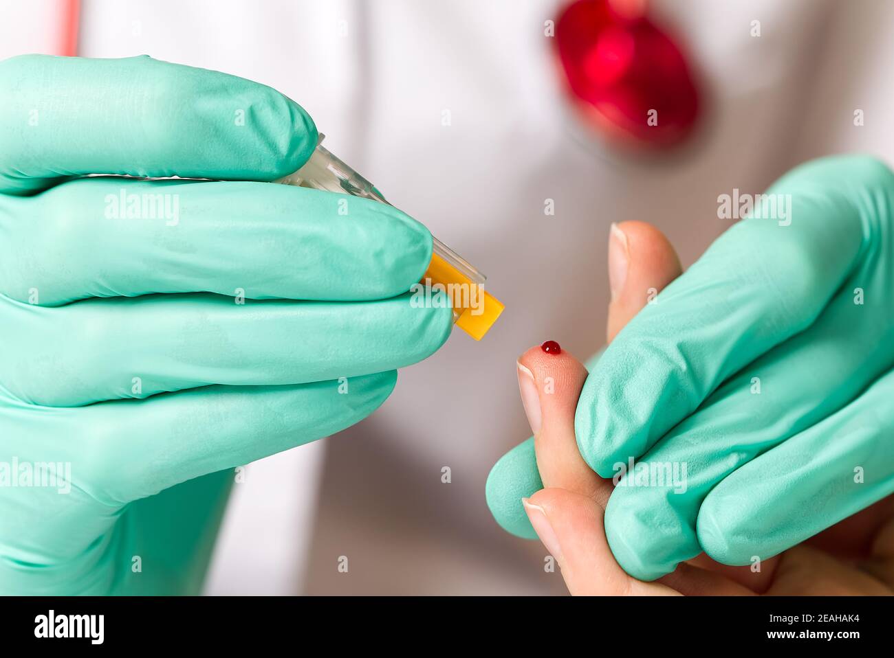 COVID19 test and laboratory sample of blood testing for diagnosis new