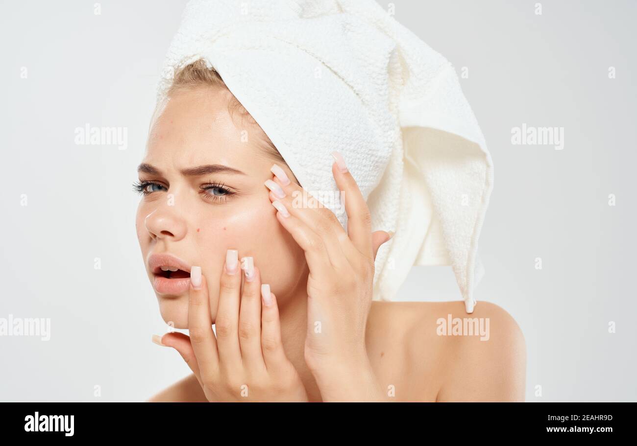 A woman with a towel on her head squeezes out acne on her face problem skin cosmetology