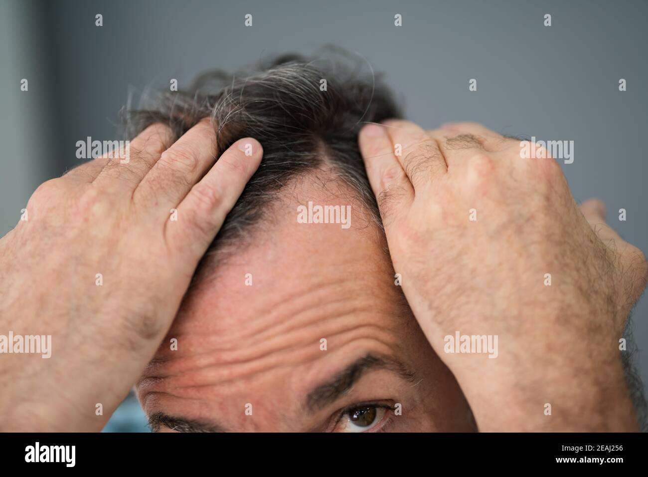 Man Checking His Hair Loss Stock Photo