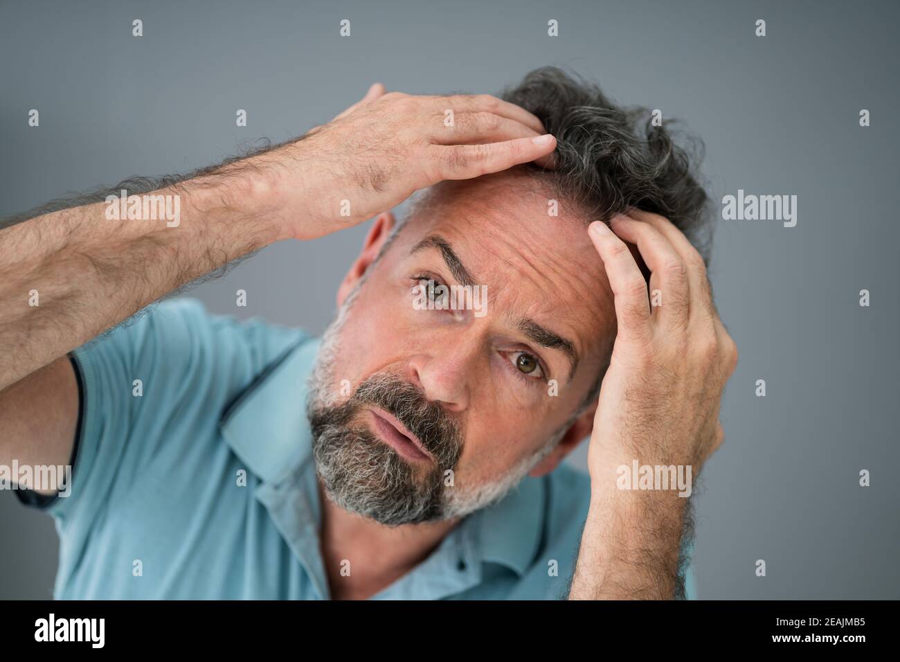 Man Checking His Hair Loss Stock Photo