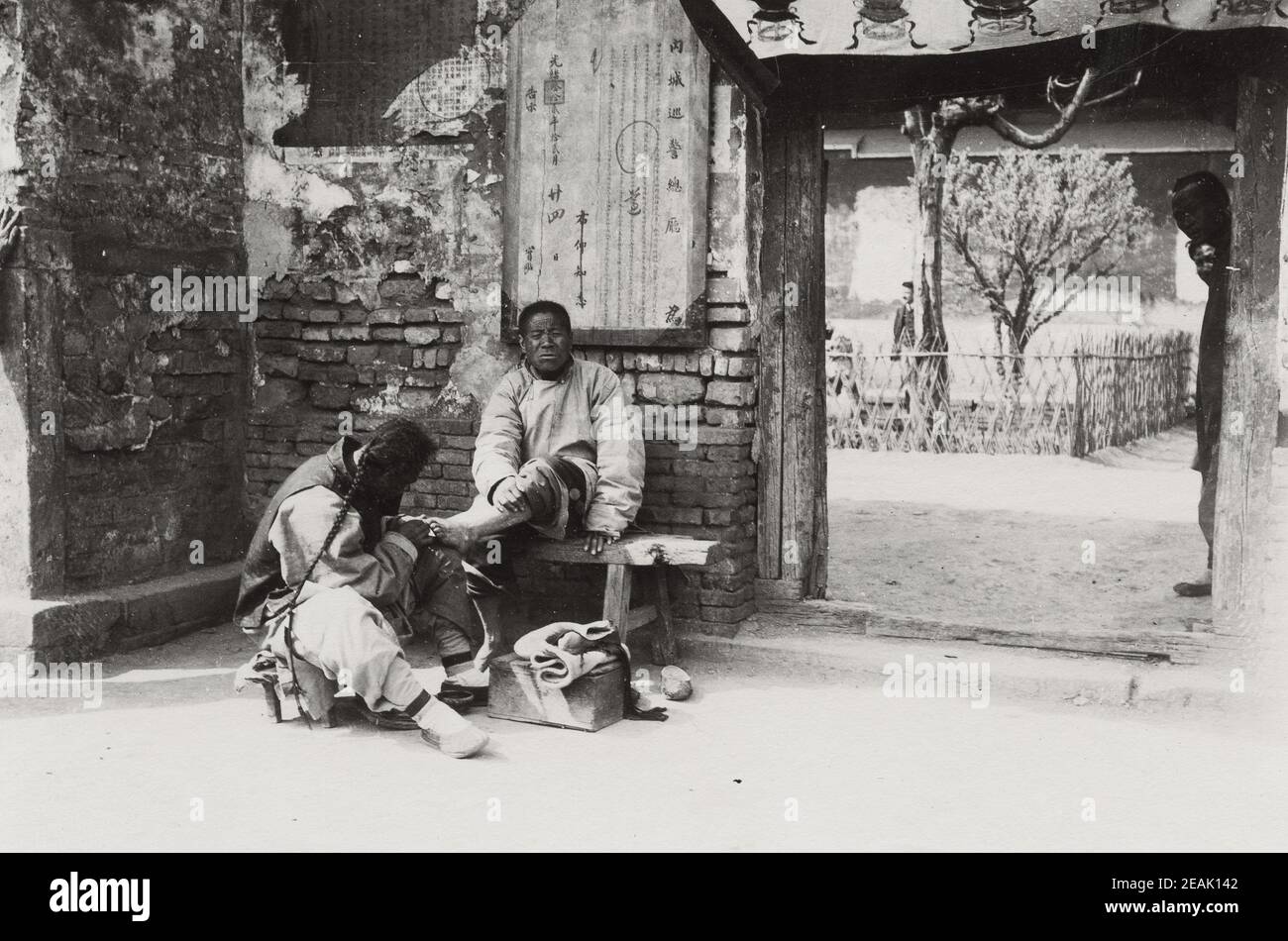 Early 20th Century Photograph Daily Life Man Having His Toenails Cut Early 20th Century Photograph Daily Life Man Having His Toenails Cut