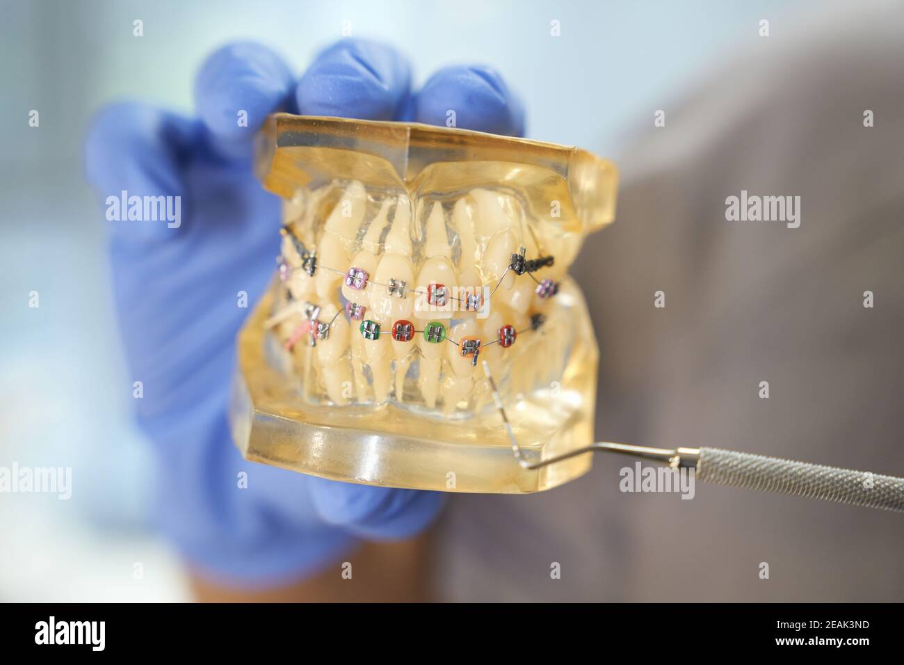 Dental specialist showing a set of braces on teeth set Stock Photo Alamy