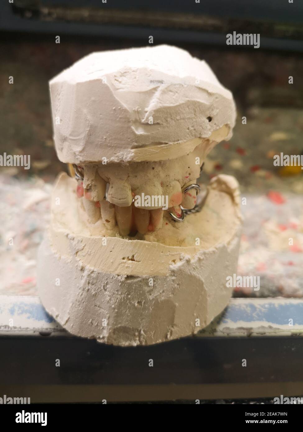 plaster footprint cast denture Stock Photo Alamy
