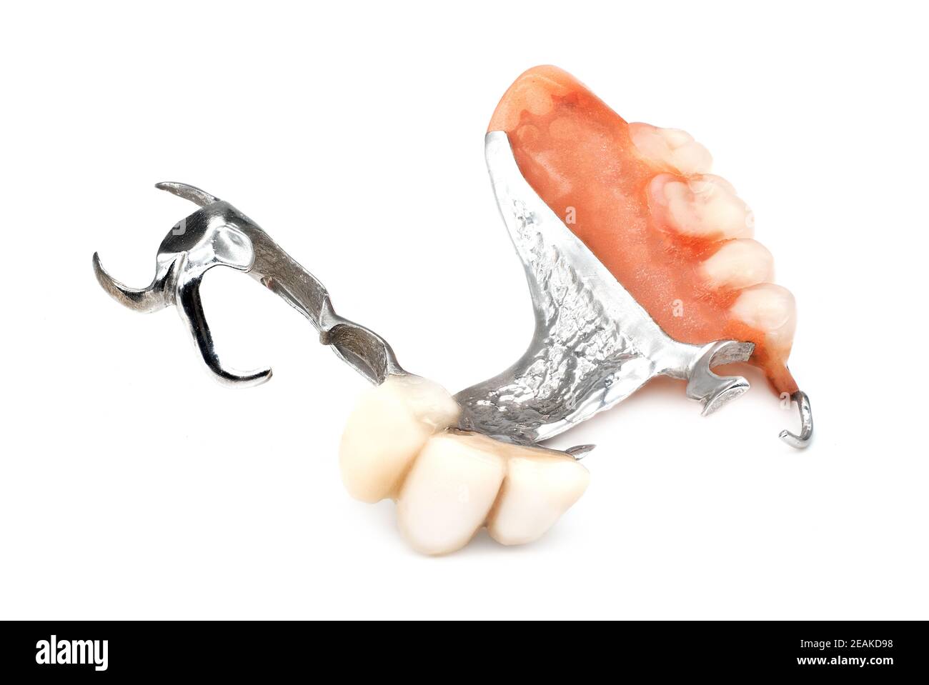 Removable Partial Denture Stock Photo