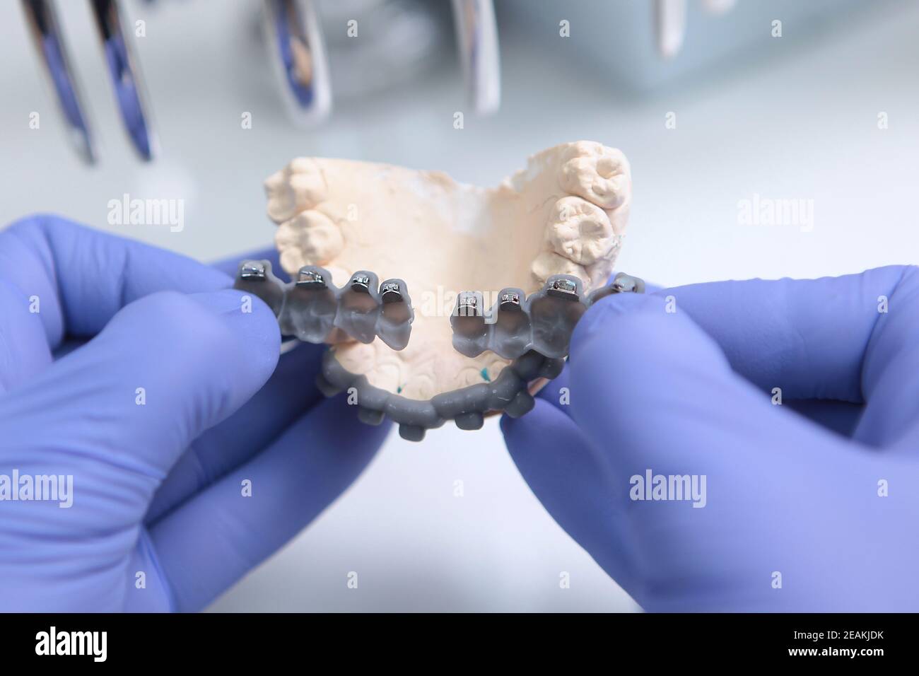 Metal braces teeth hires stock photography and images Alamy