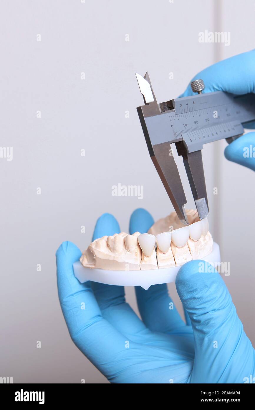 A dental technician makes the measurement of the veneers. Ceramic and composite veneers. Hands in protective gloves. The concept of beauty and health. Unrecognizable person.Vertical photo. Stock Photo