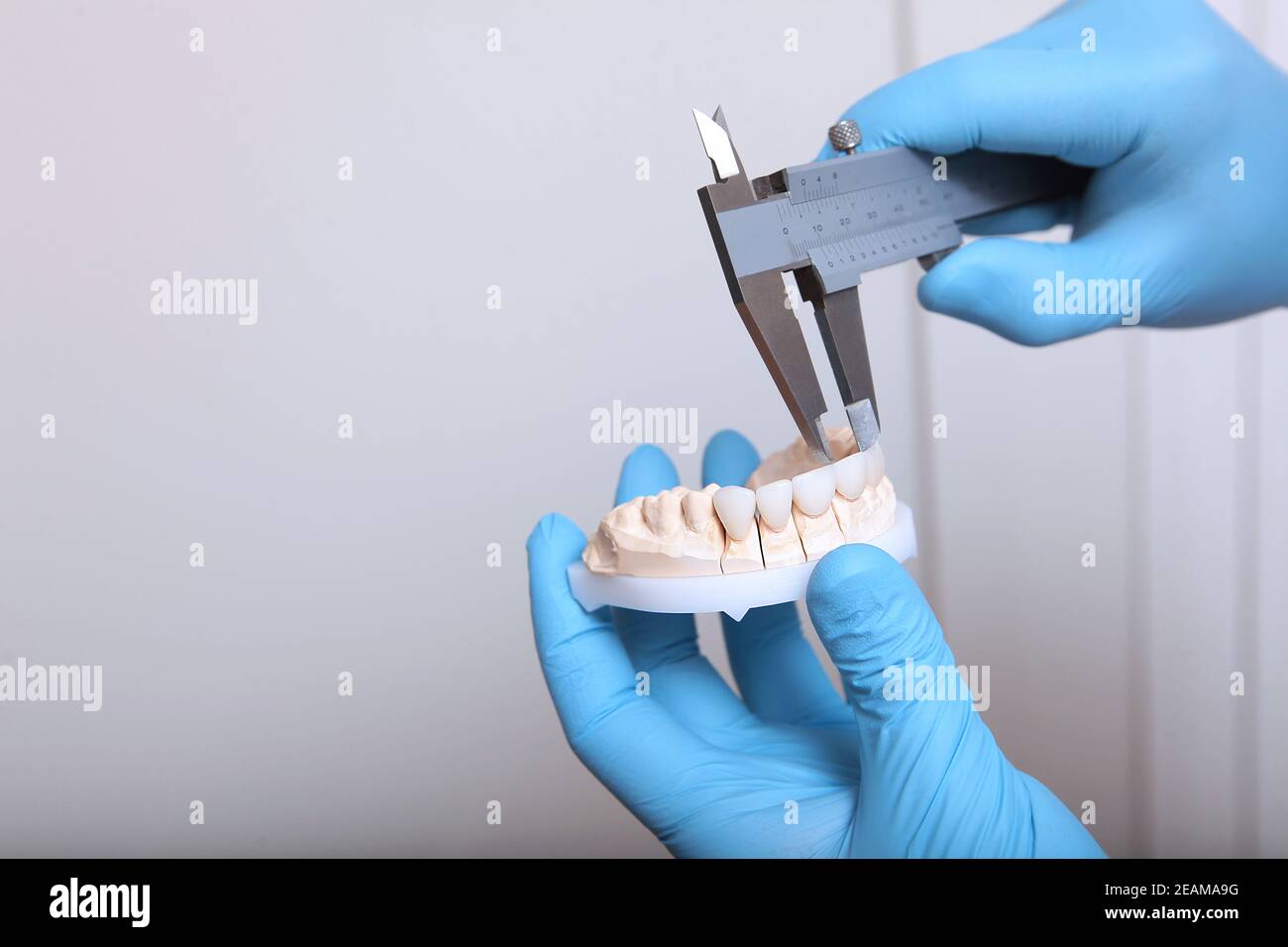 A dental technician makes the measurement of the veneers. Ceramic and composite veneers. Hands in protective gloves. The concept of beauty and health. Unrecognizable person. Stock Photo