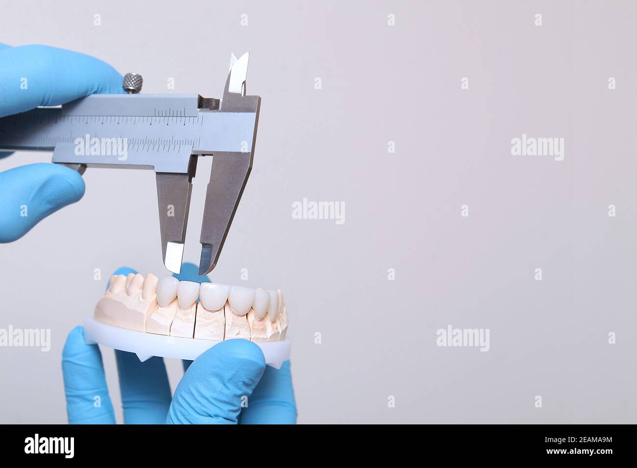 Ceramic and composite veneers. A dental technician makes the measurement of the veneers. Hands in protective gloves. The concept of beauty and health. Unrecognizable person. Stock Photo