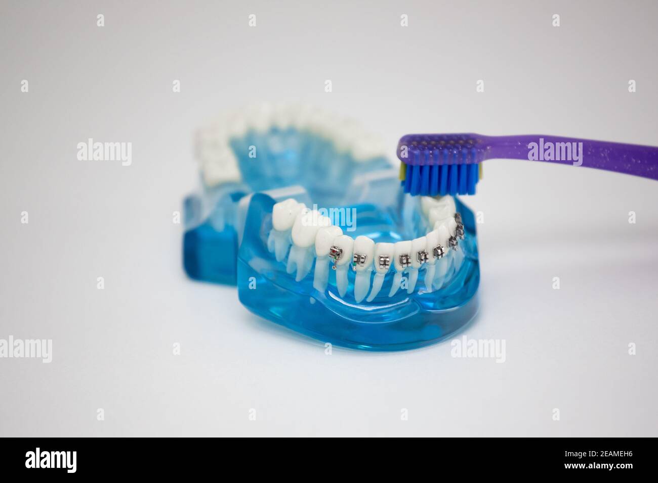 Typodont with the installation of the braces with a toothbrush Stock Photo Alamy