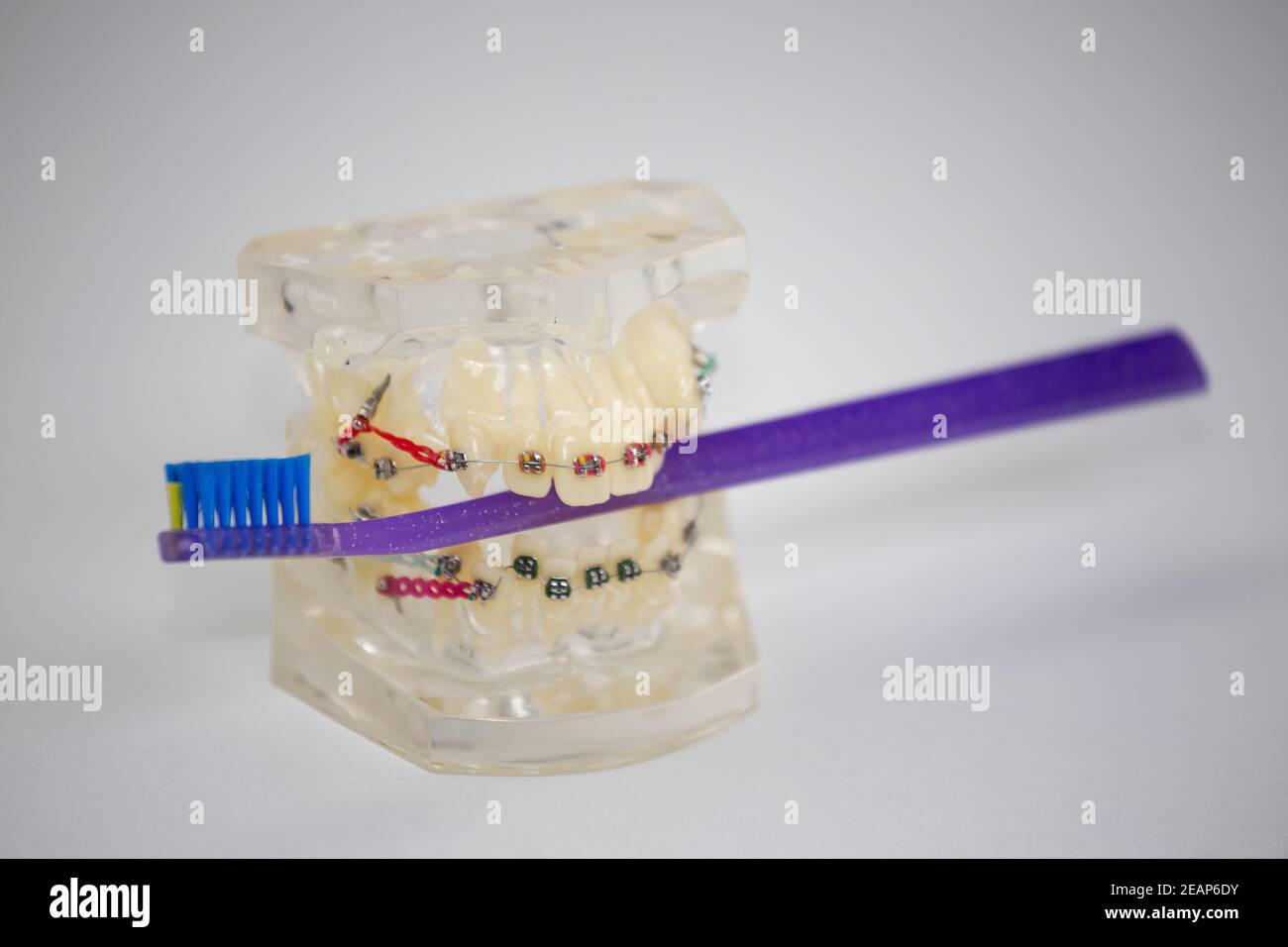 Typodont with the installation of the braces with a toothbrush Stock Photo