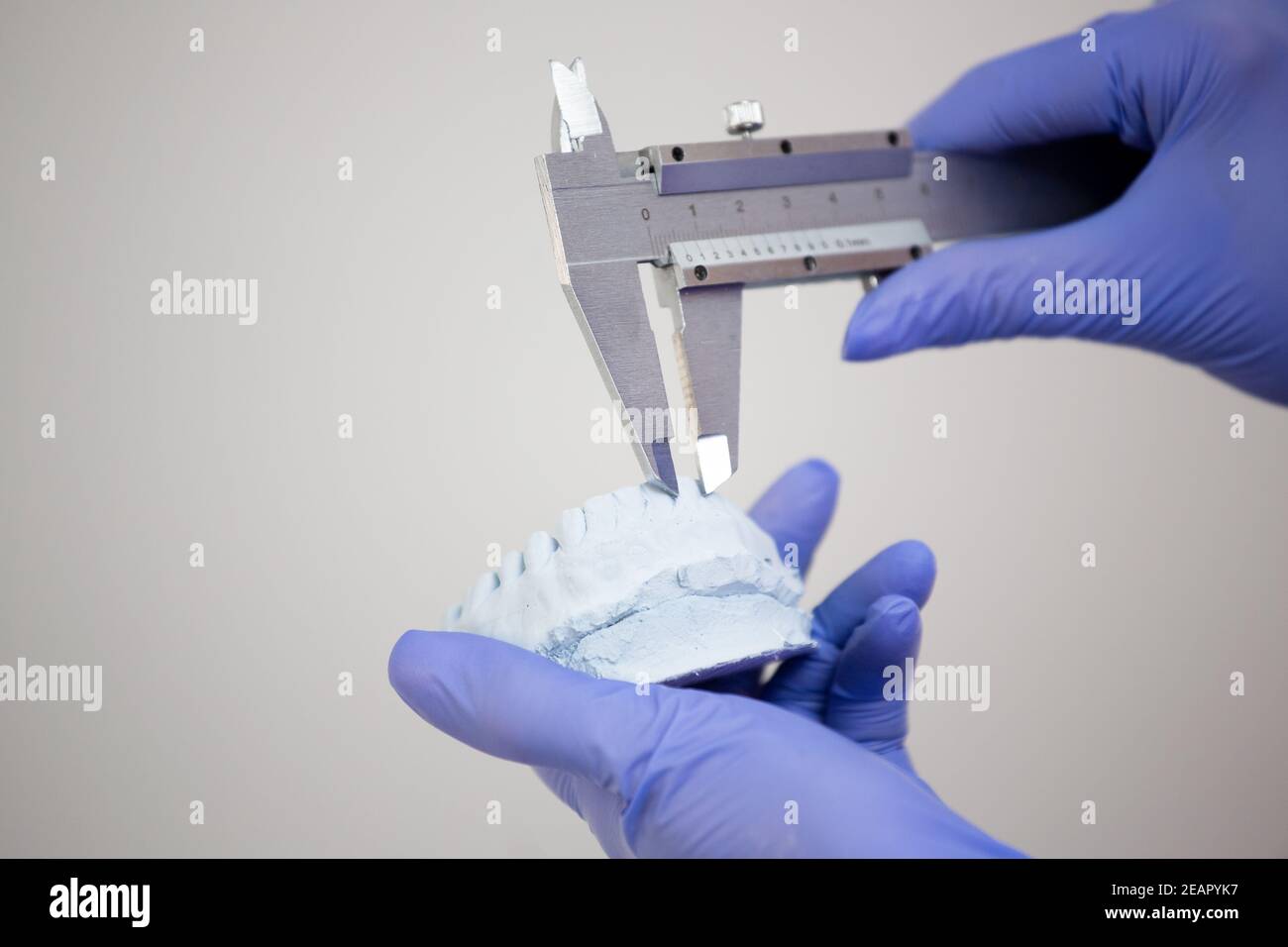 The dentist holds the jaw and measures the teeth with a caliper Stock ...