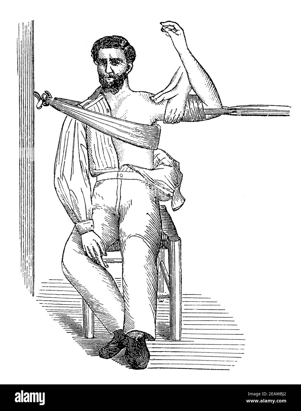 Surgeon's devices for dislocating the shoulder. Illustration of the 19th century. Germany. White background. Stock Photo