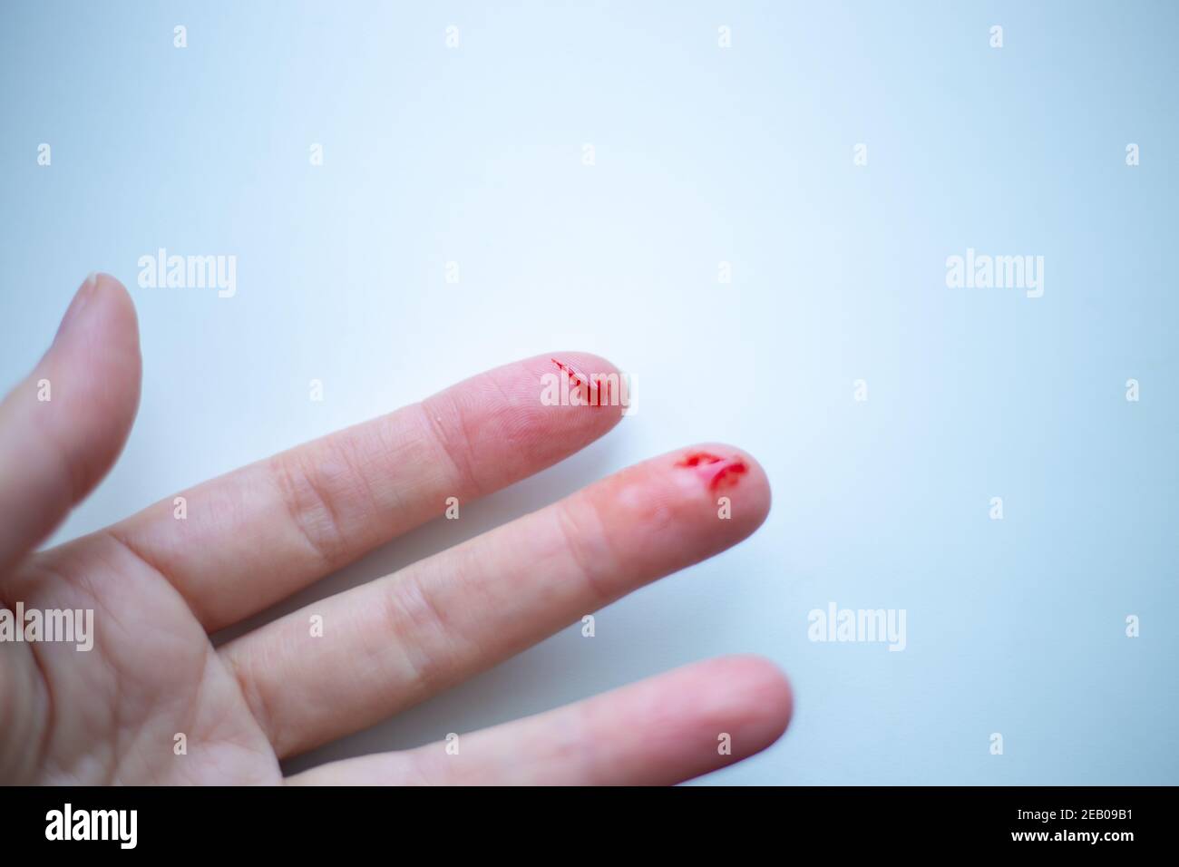 finger on his left hand is cut and bleeds with bright red blood on a light background Stock Photo