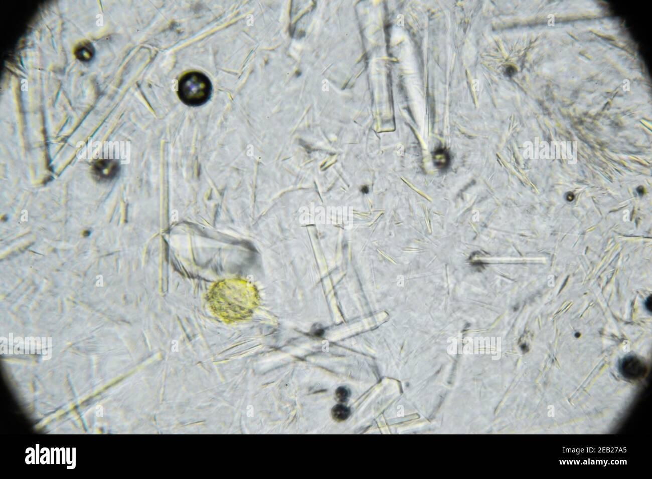 Artificial honey with large rectangular sugar crystals under microscope