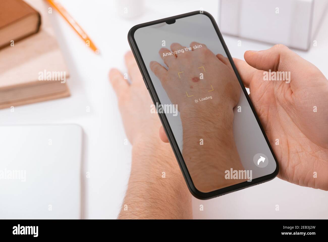 Man using a phone app to identify skin disease on his hand Stock Photo - Alamy Man using a phone app to identify skin disease on his hand Stock Photo - Alamy