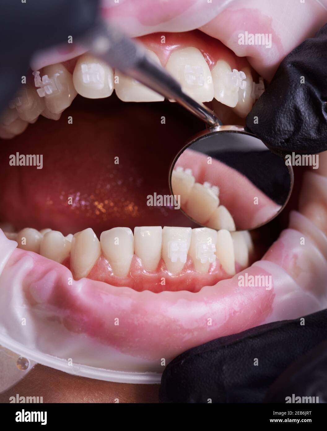 Dentist checking patient's lower teeth with a help of mirror. Close up
