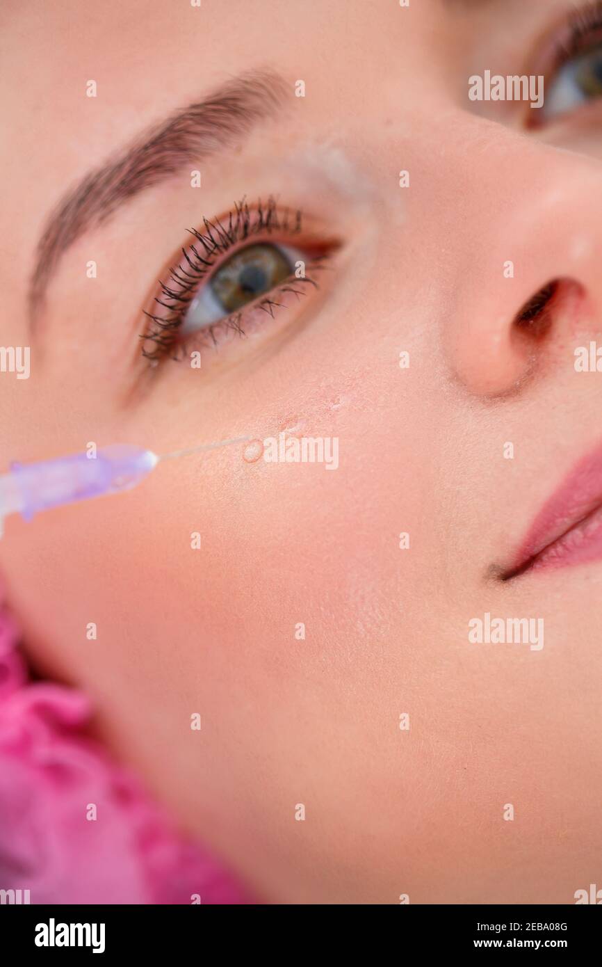 Cosmetology concept. Current trends in cosmetic procedures. Beauty