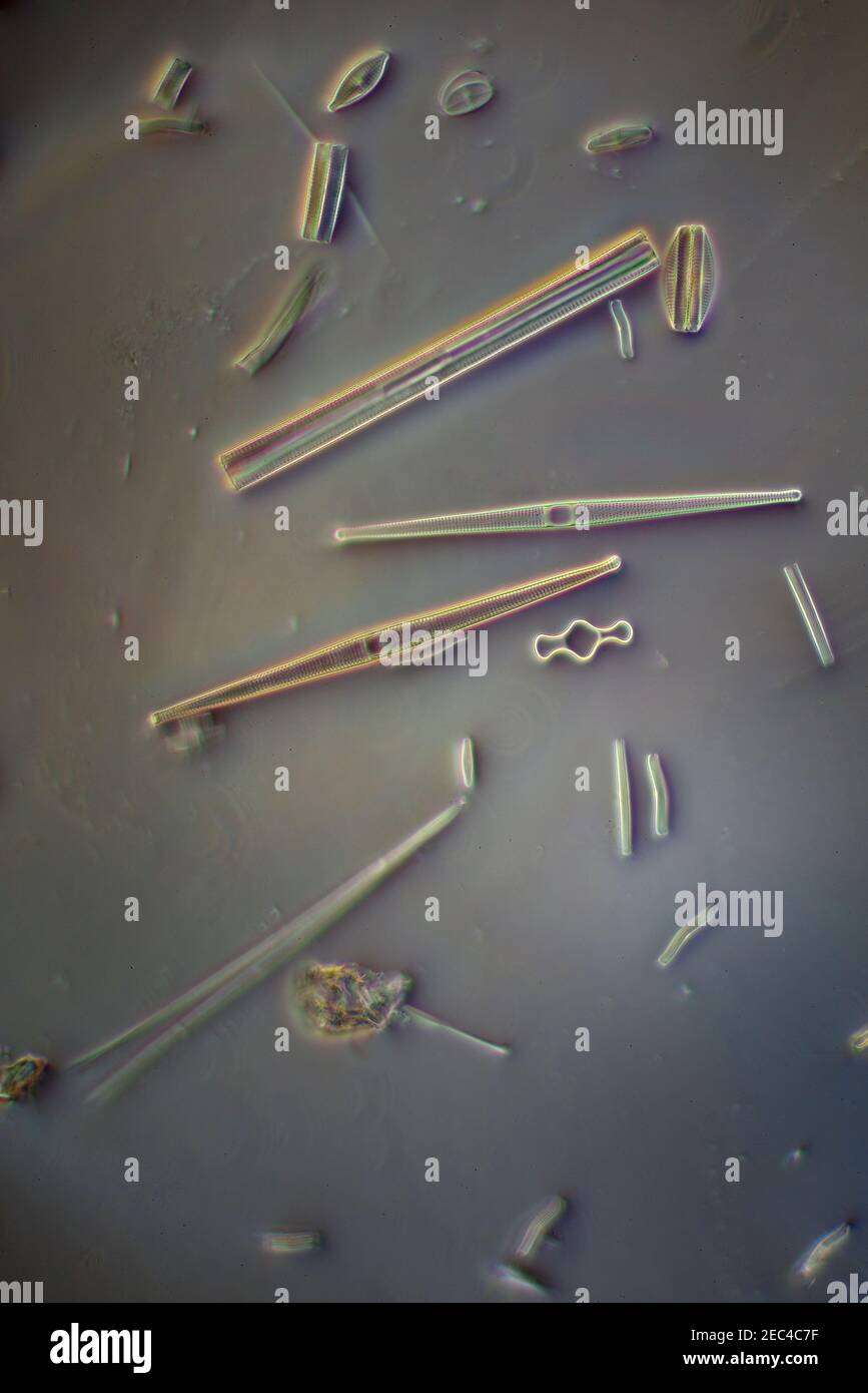 Diatoms, Yorkshire, UK. Oblique illumination, photomicrograph Stock Photo