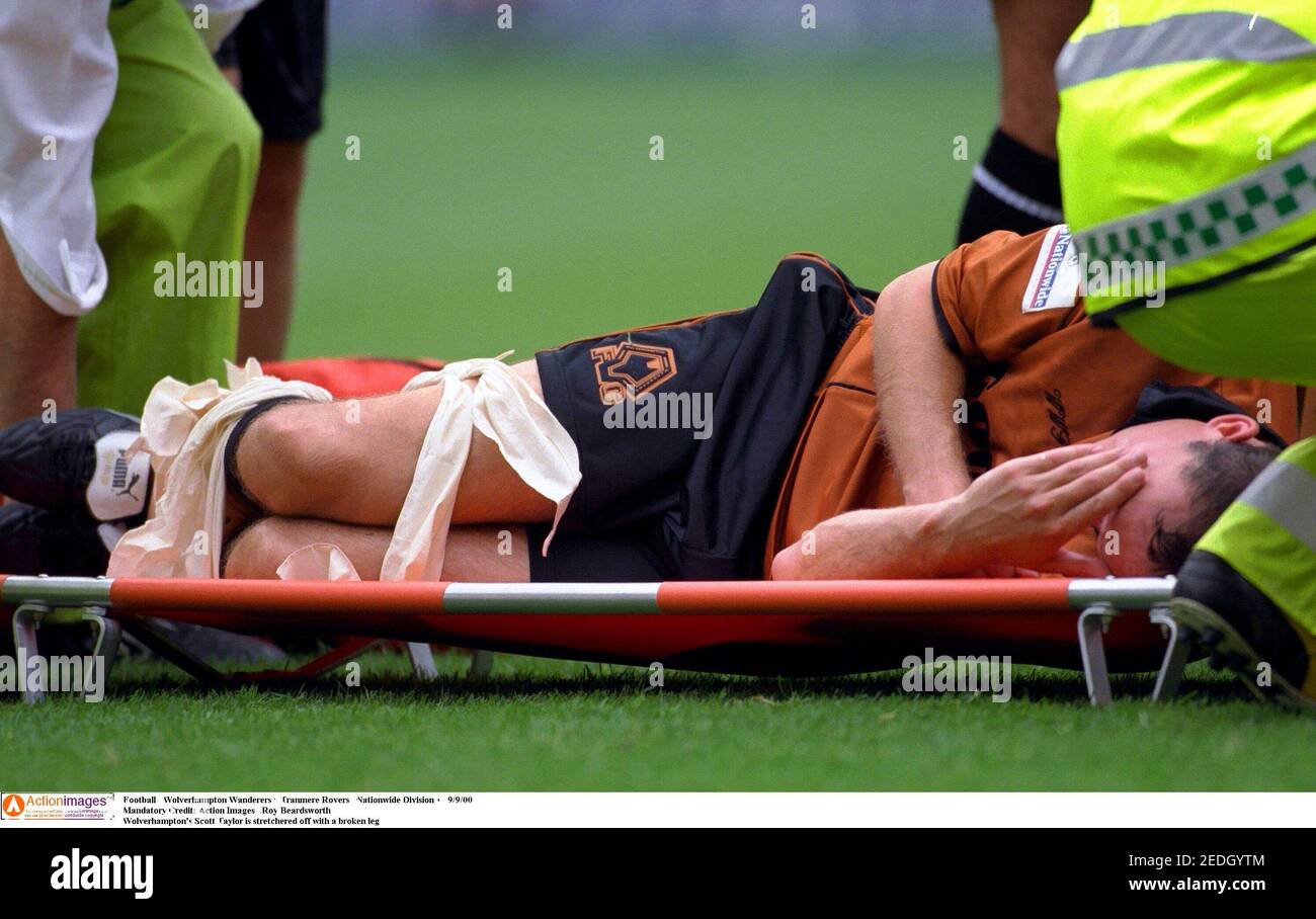Football broken leg hi-res stock photography and images - Page 4 - Alamy