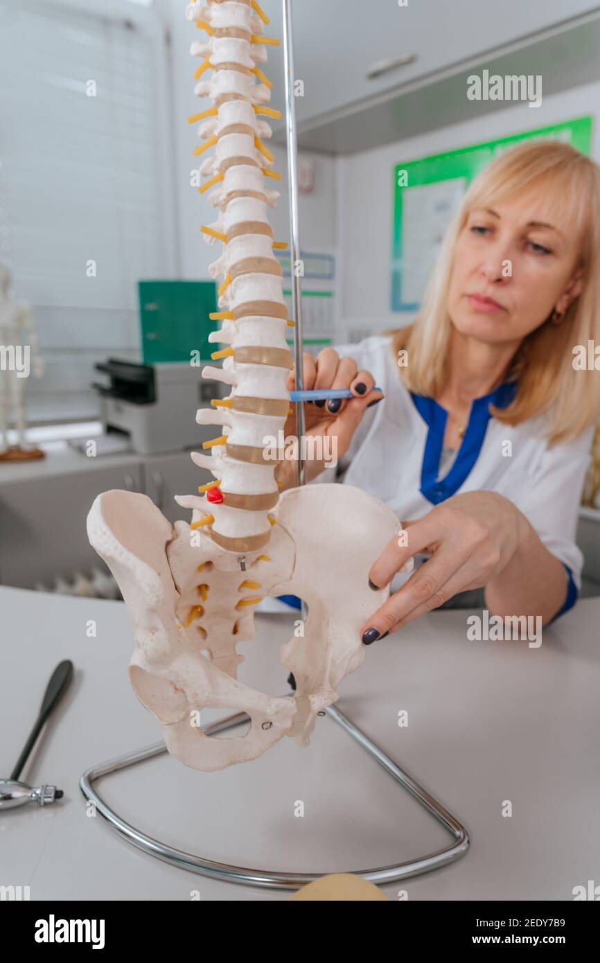 Doctor physiotherapist explaining the mechanism of injury using spine model Stock Photo