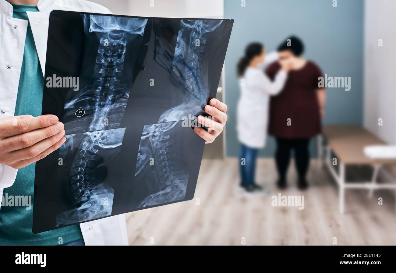 doctor holds an x-ray of a cervical spine over background osteopath check-up overweight woman's spine. Scoliosis of spine, diagnosis Stock Photo