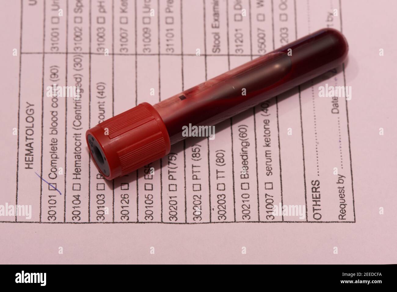 Blood drawn in test tube and paper request form for complete blood