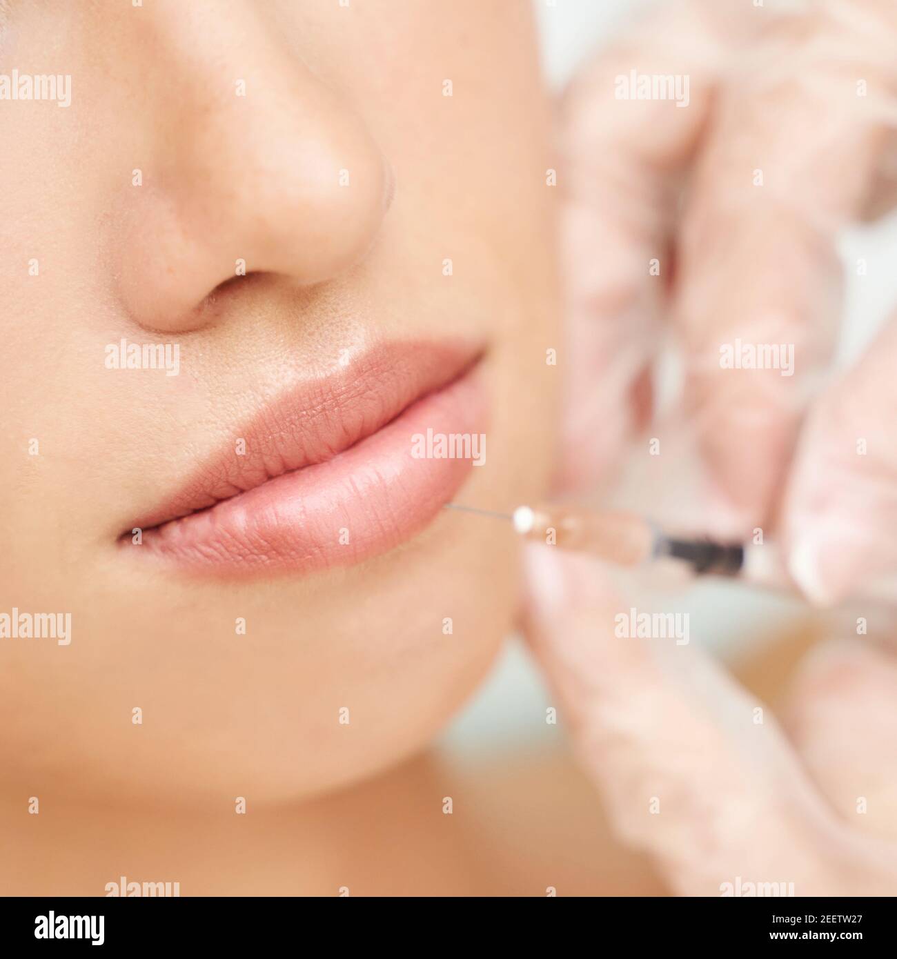 Lip injection at spa salon. Doctor hands. Closeup view. Pretty female