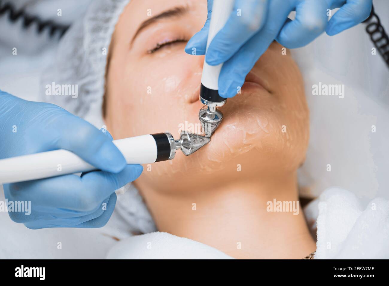 Correction of facial contours in modern cosmetology. Stock Photo