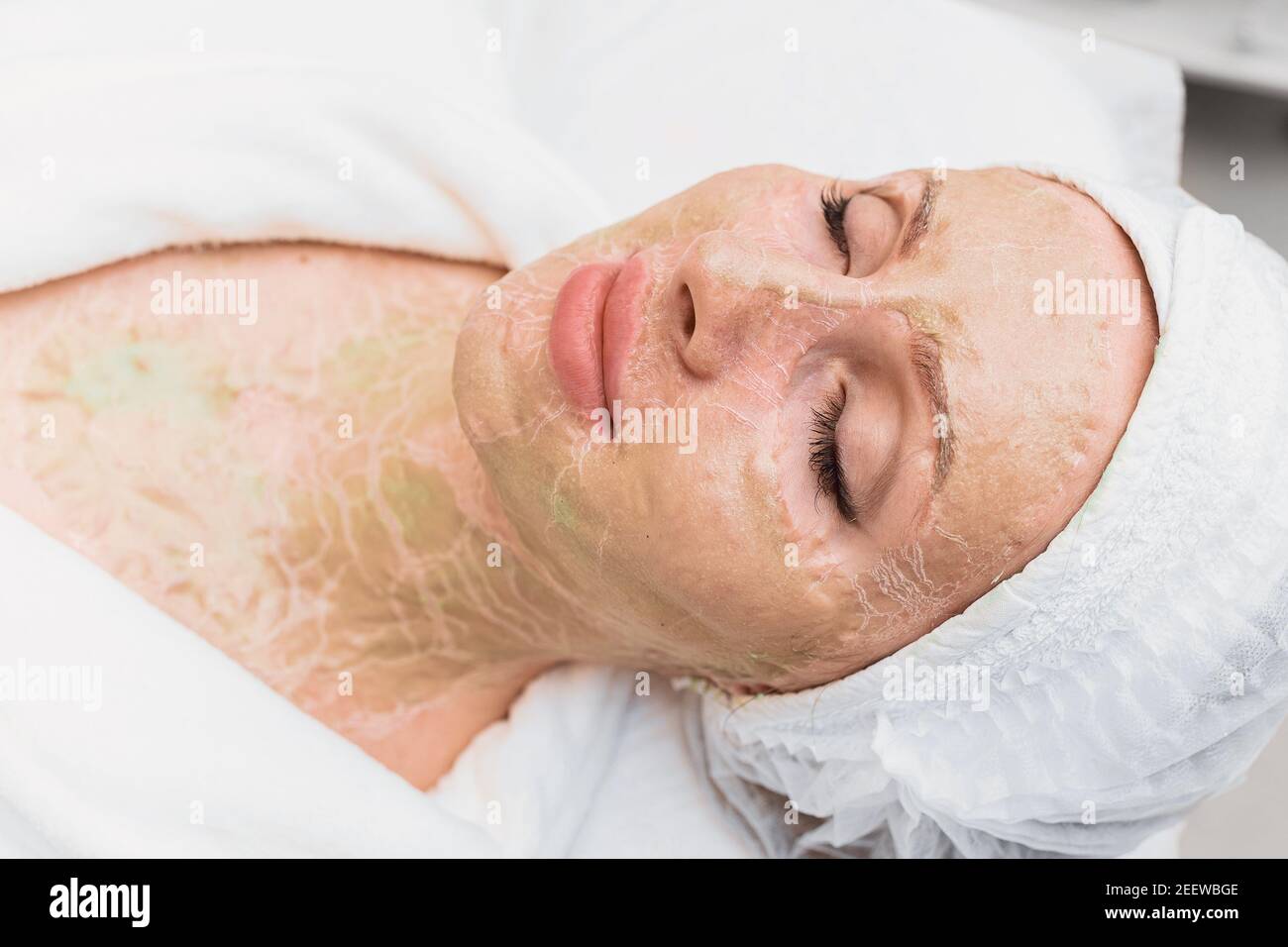 Dried enzyme mask on the face and neck of a woman. Rejuvenation and facelift in a cosmetology