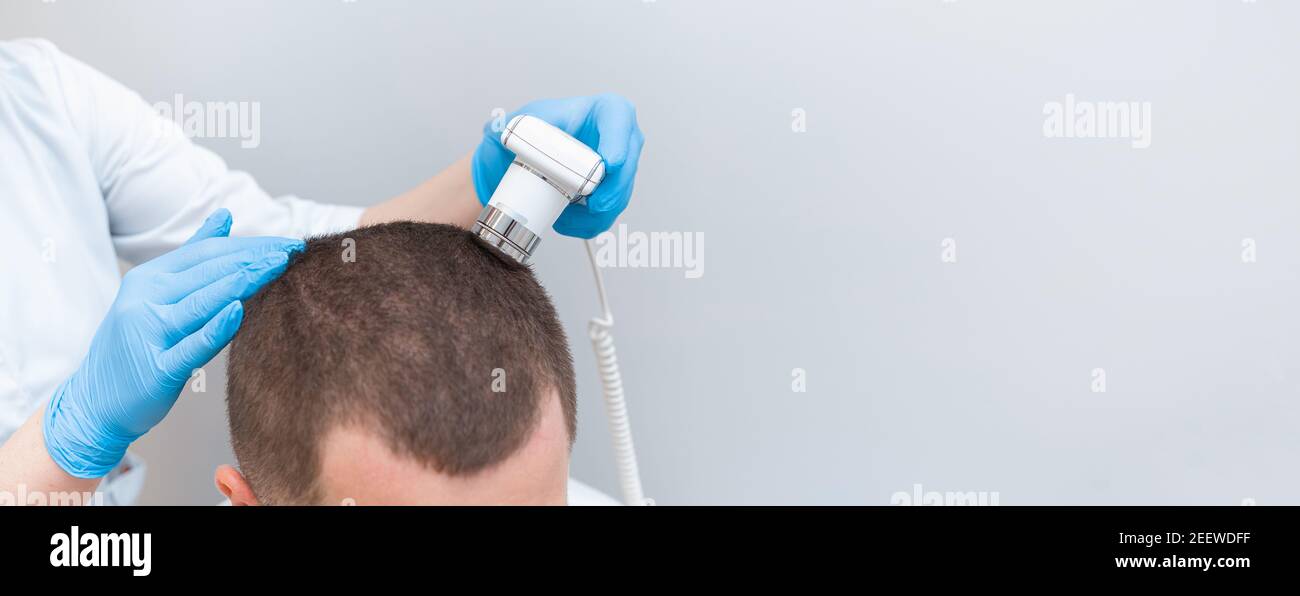 Trichoscope examination of hair, scalp and hair follicles of a young