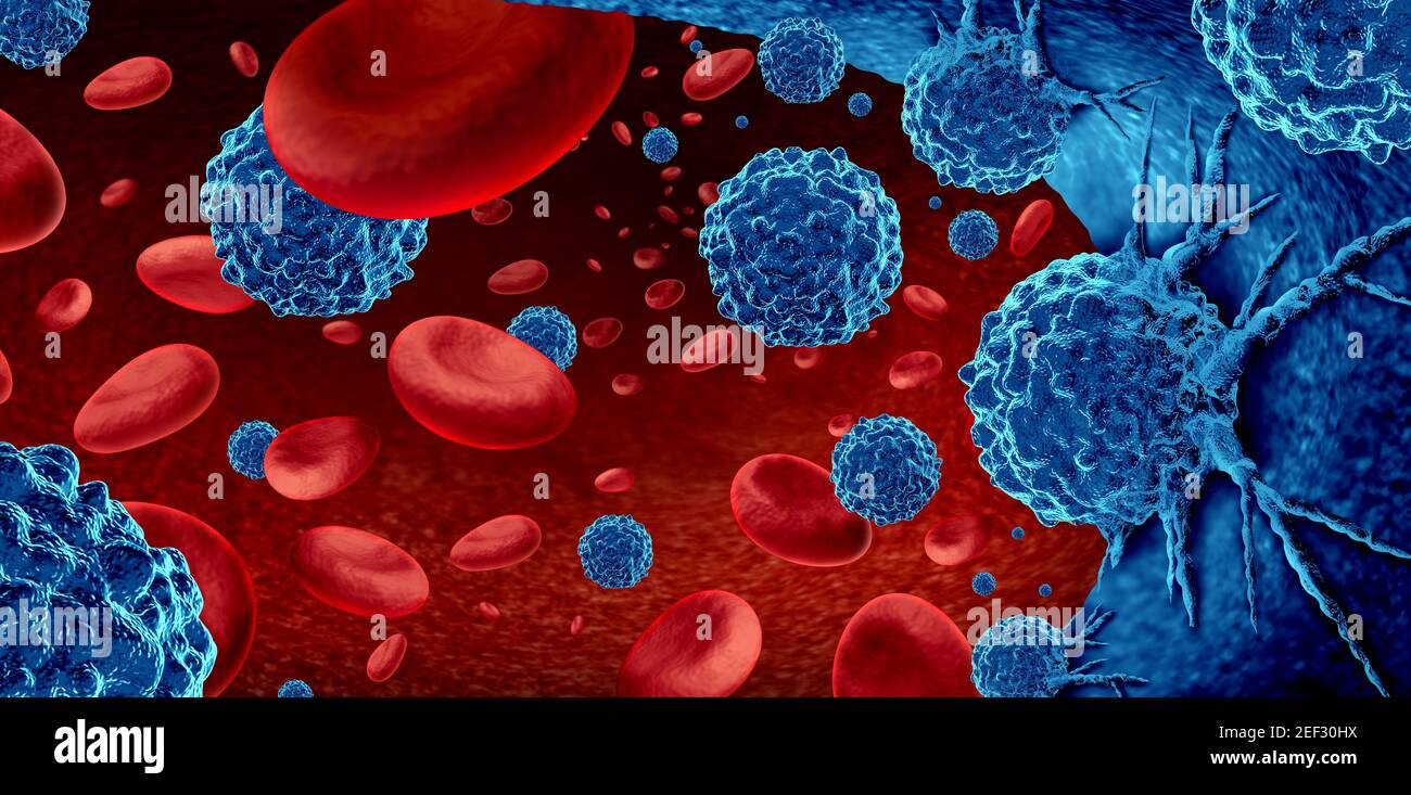 Cancer in the blood outbreak and treatment for malignant cells in a human body caused by carcinogens and genetics with a cancerous cell. Stock Photo