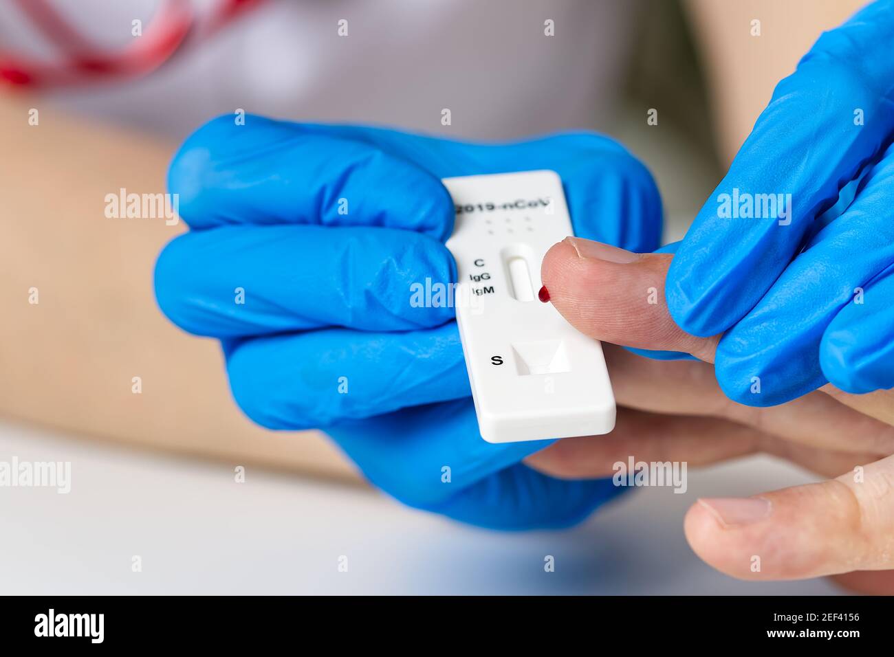 COVID19 test and laboratory sample of blood testing for diagnosis new
