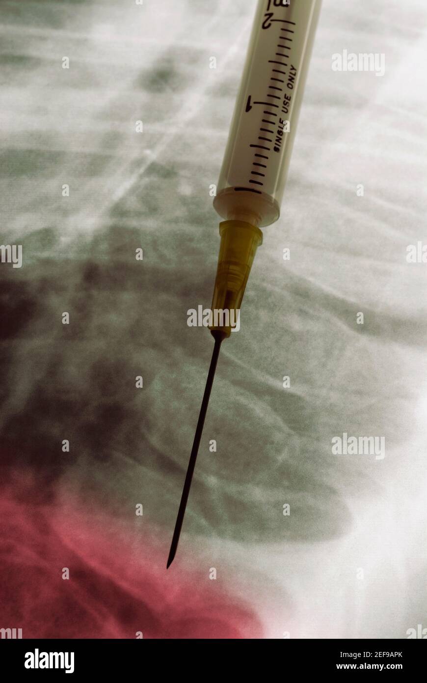 Close up of a syringe on an X Ray Stock Photo Alamy