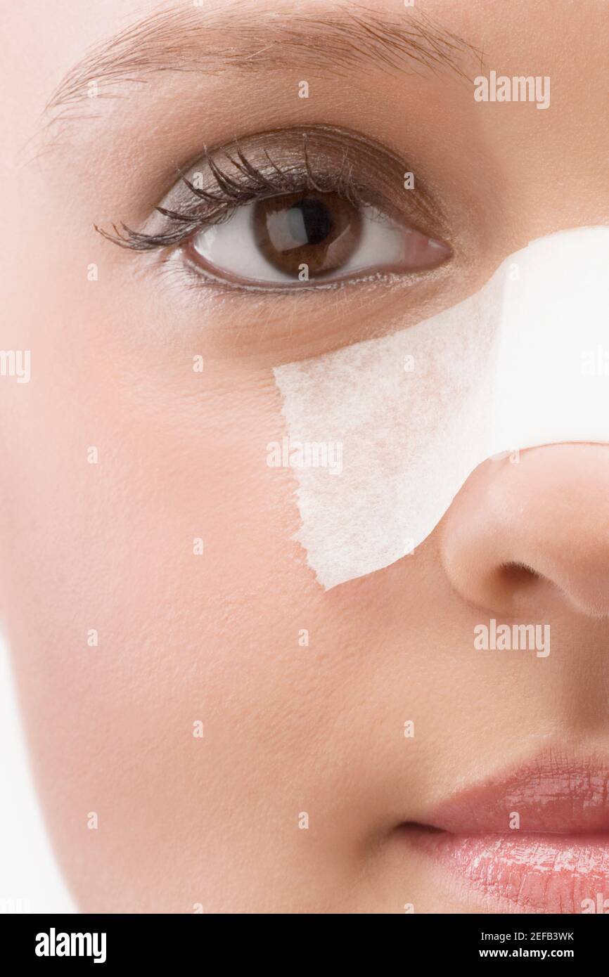 Nose bandage hires stock photography and images Alamy