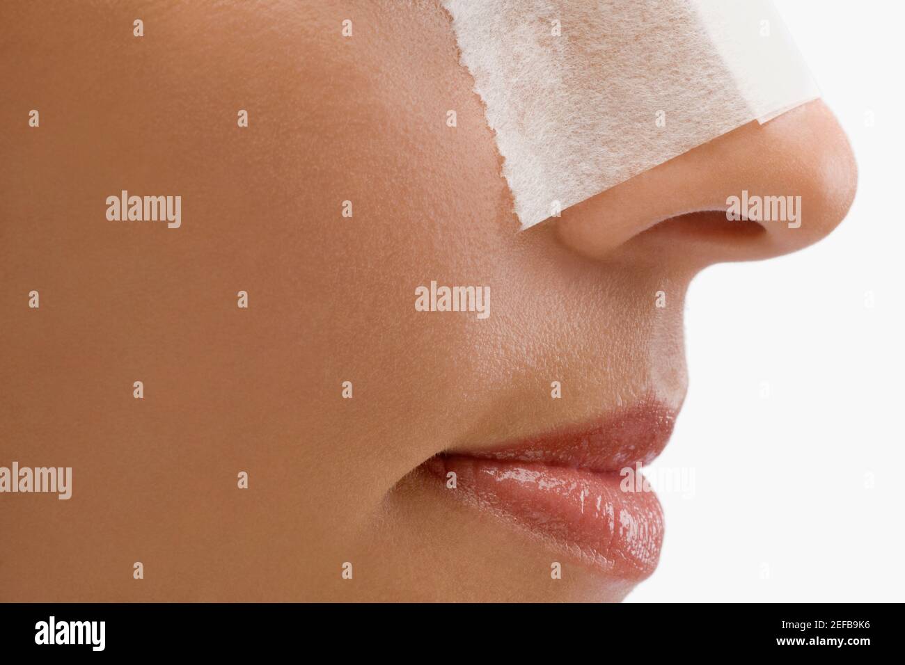 Nose bandage hires stock photography and images Alamy