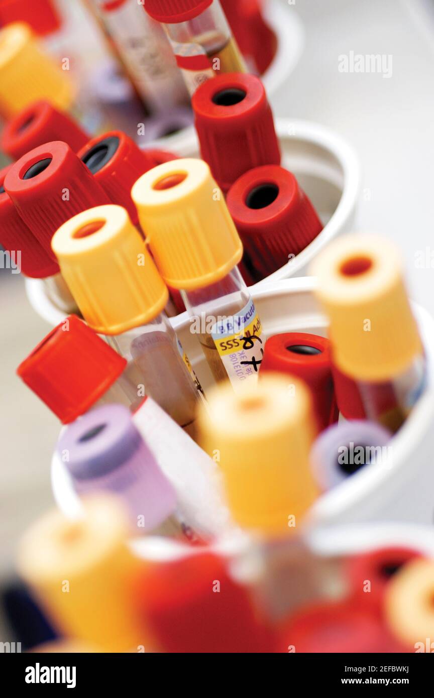Specimen containers hi-res stock photography and images - Alamy