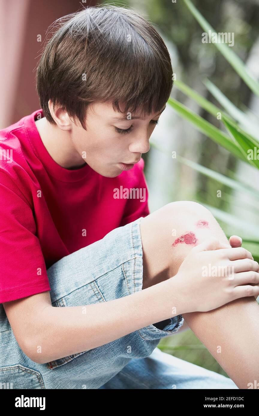 Close up of a boy holding his wounded knee Stock Photo