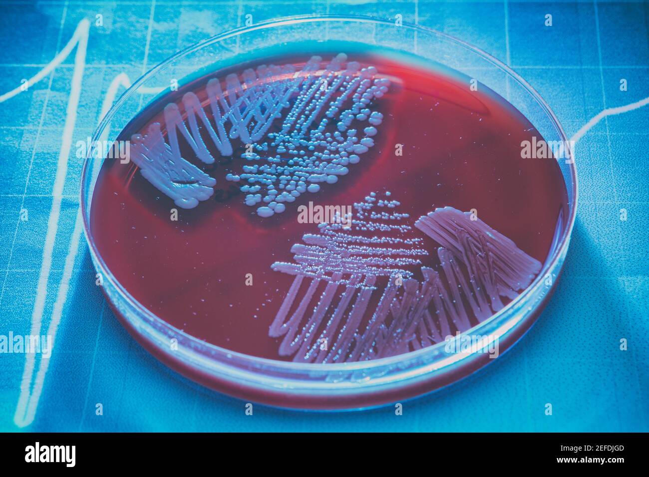 Petri plate with bacteria Steptococcus Phaemolifticus G, Streptococcus Agalactiae, Streptococcus Phaemolifticus Stock Photo