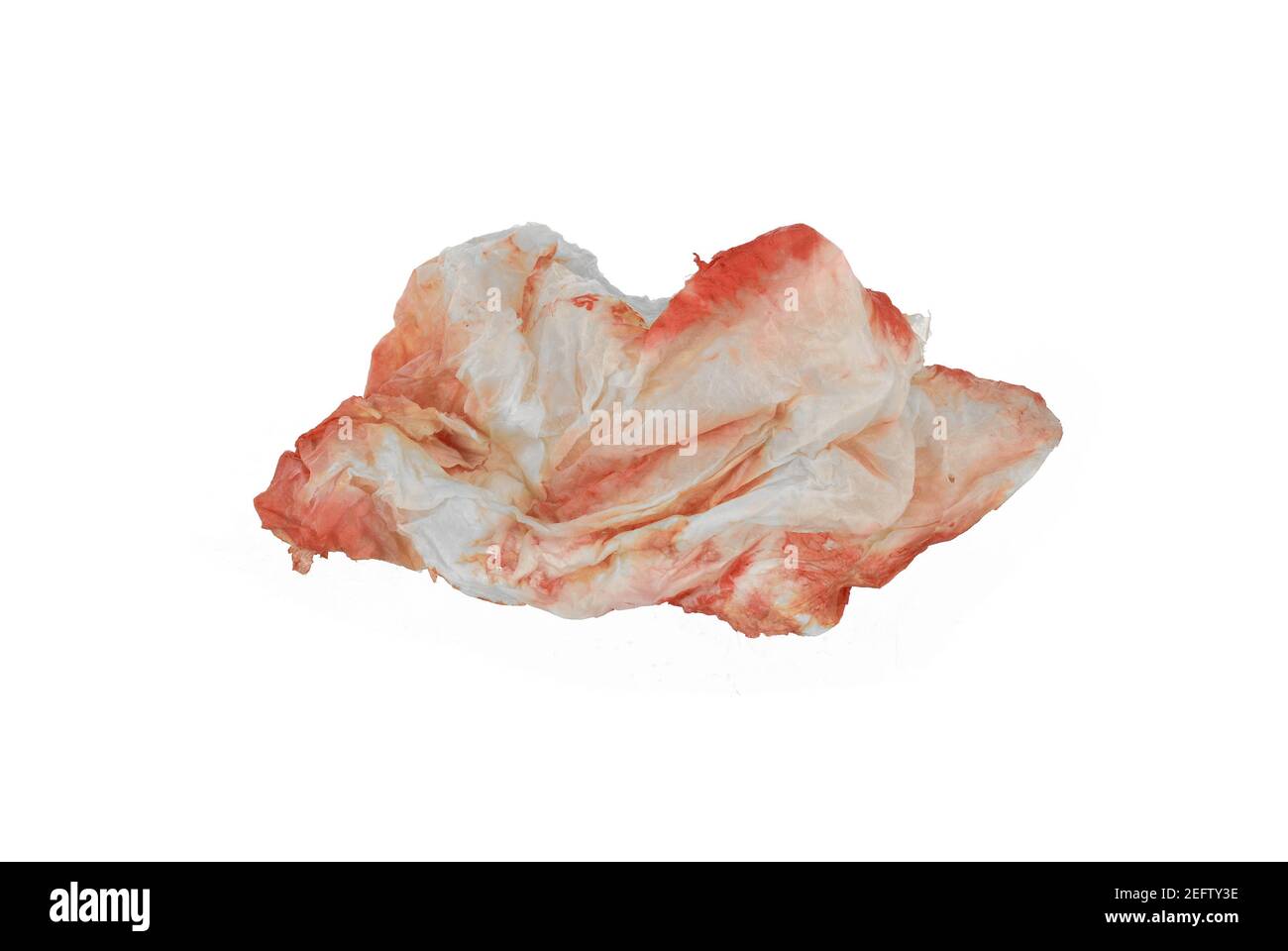 Blood in tissue paper on a white background. Epistaxis (nosebleeds