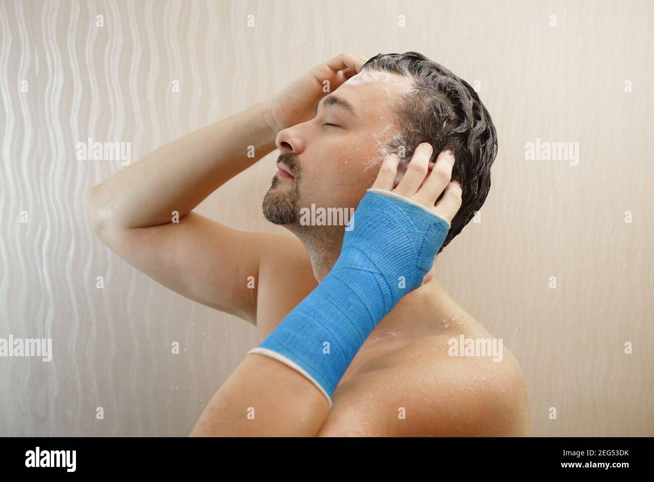 Take shower hand wrapped in fiberglass cast Stock Photo Alamy