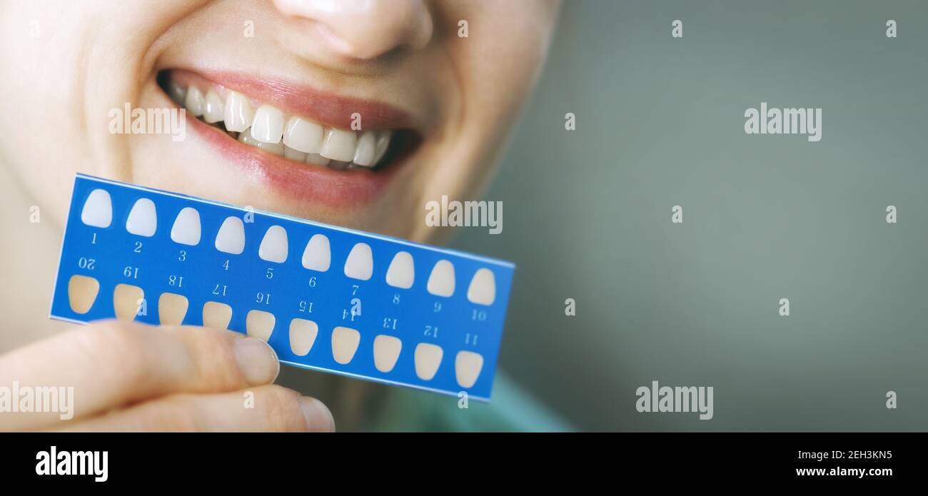 woman using teeth whitening shade guide. tooth bleaching. banner copy space Stock Photo
