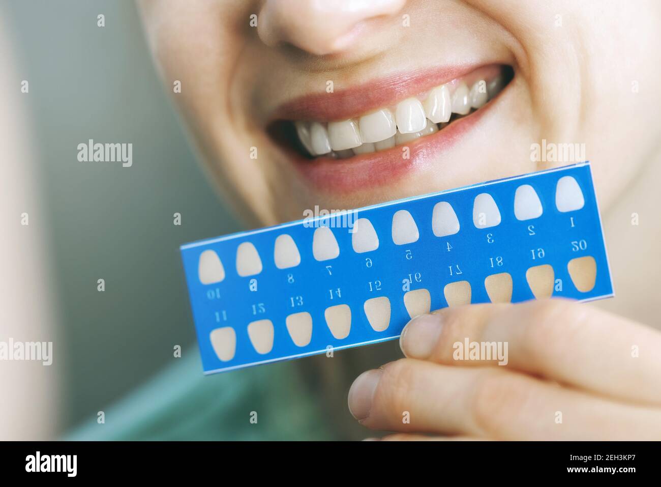 woman using teeth whitening shade guide in front of mirror. tooth bleaching Stock Photo