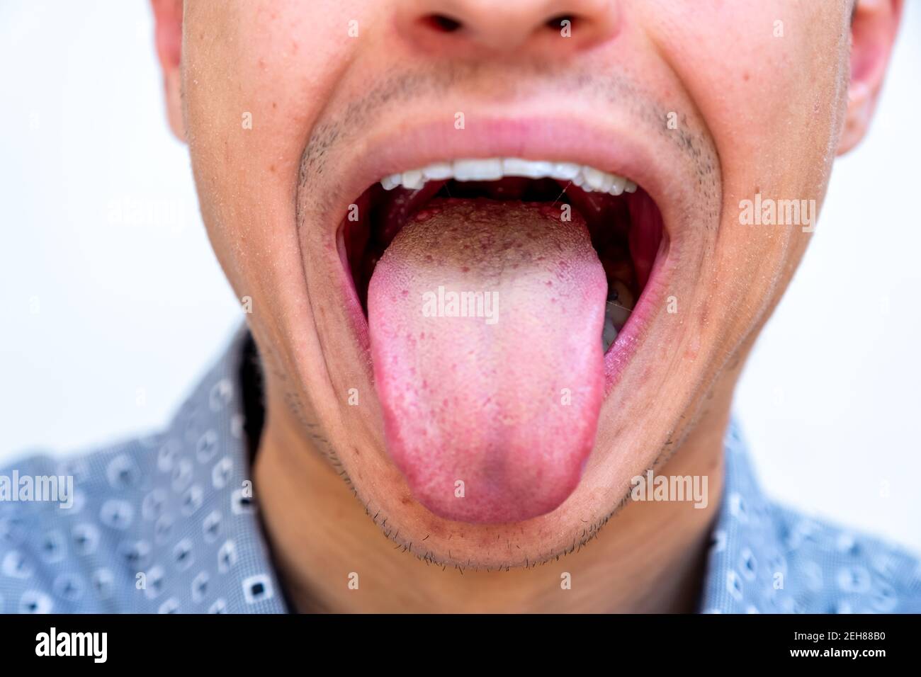 Man Mouth Open Showing Tongue Hi-res Stock Photography And Images - Alamy