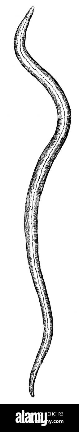 The 'large roundworm' of humans - Ascaris lumbricoides. Illustration of the 19th century. Germany. White background. Stock Photo