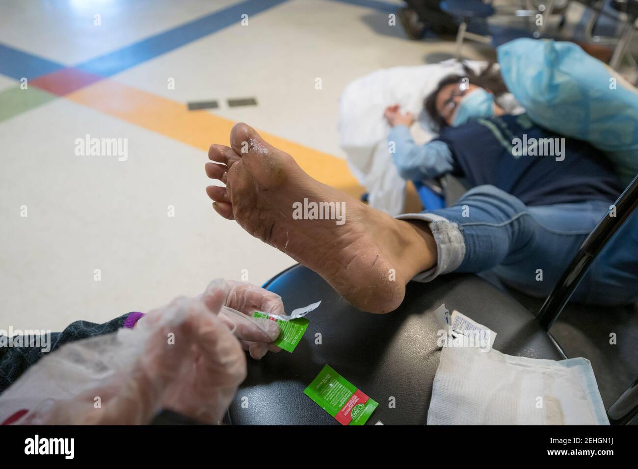 Forstbite hi-res stock photography and images - Alamy